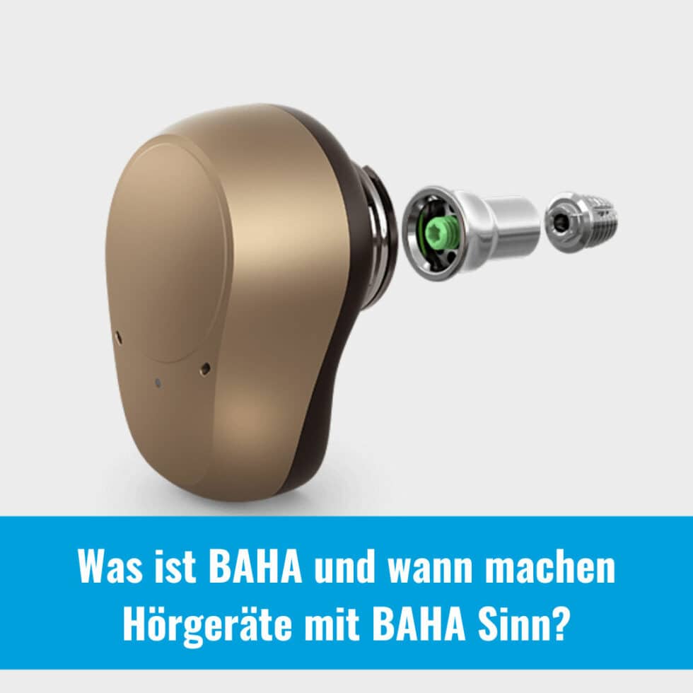 Was ist BAHA und wann machen Hörgeräte mit BAHA Sinn? - Die Experten ...