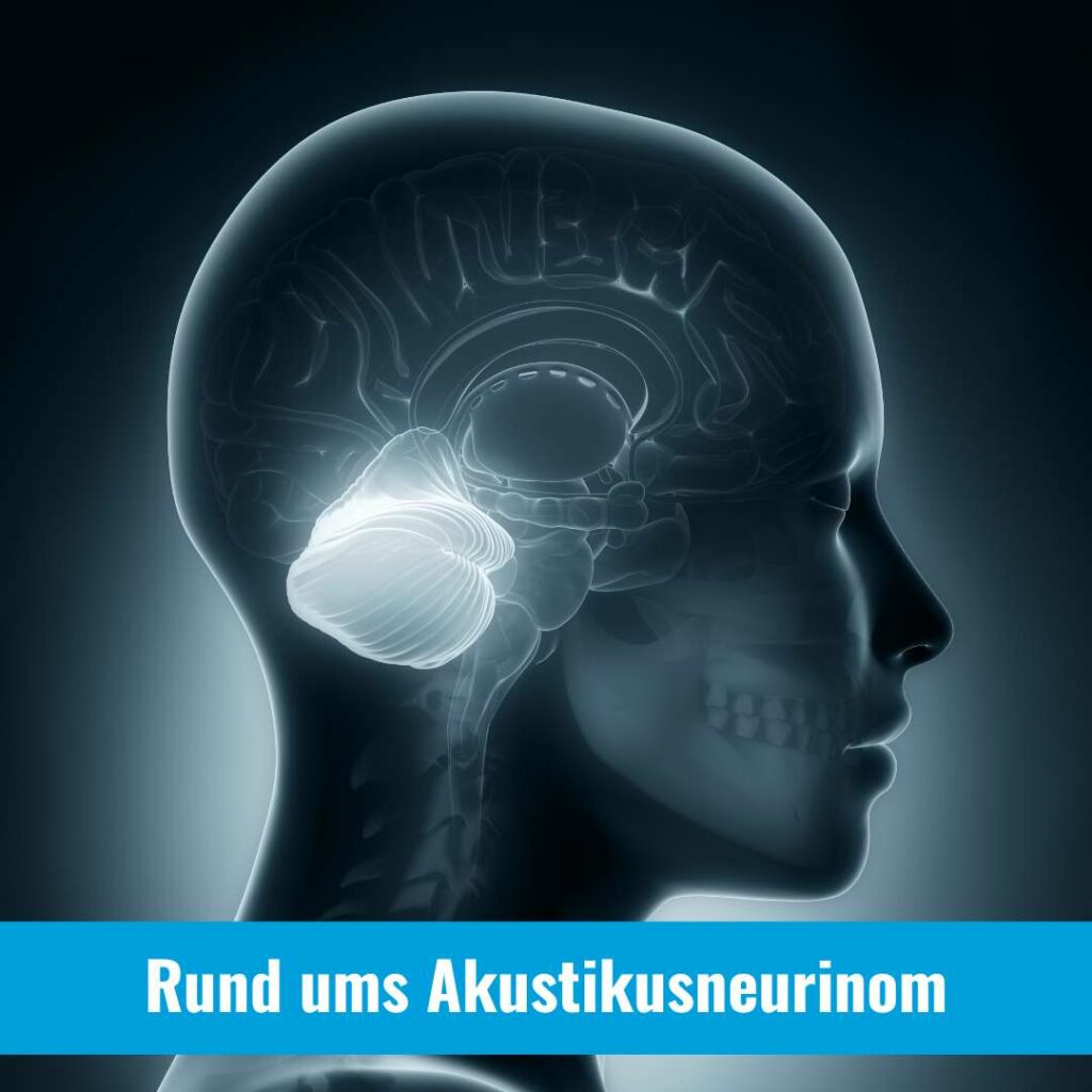 Rund ums Akustikusneurinom