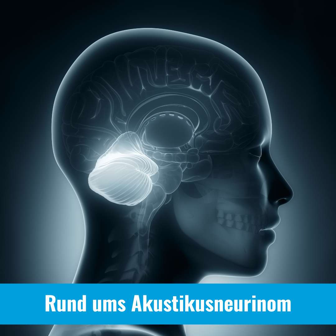 Rund ums Akustikusneurinom